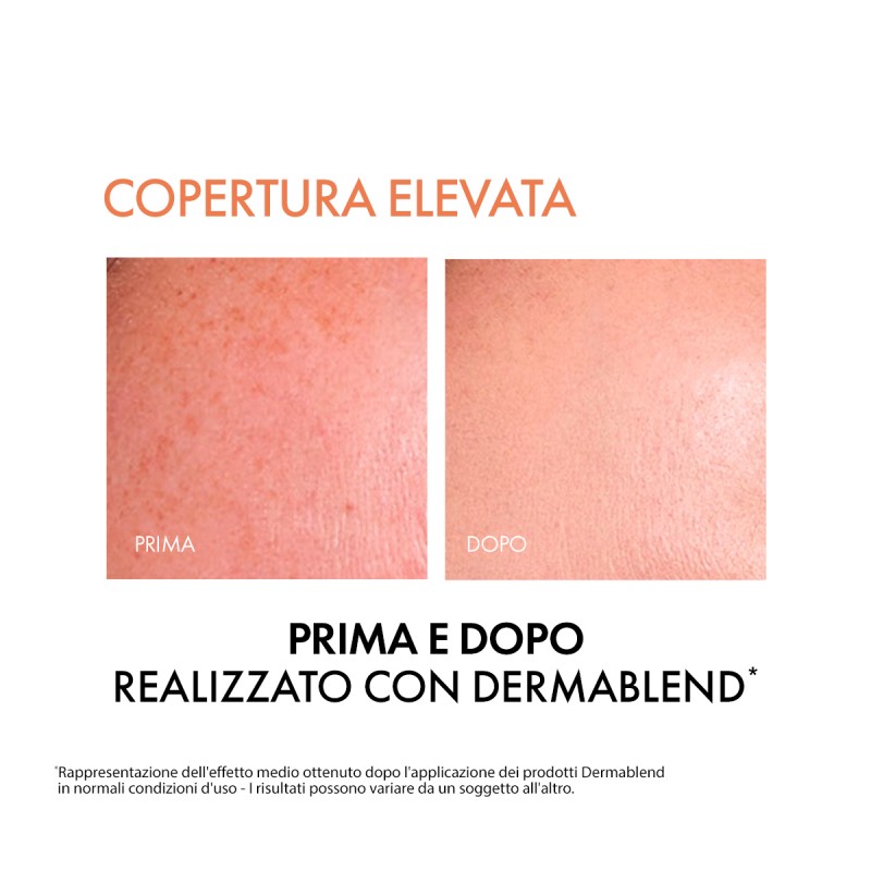 prima e dopo Vichy Dermablend Fondotinta Fluido 35 Sand Sabbia 30 ml