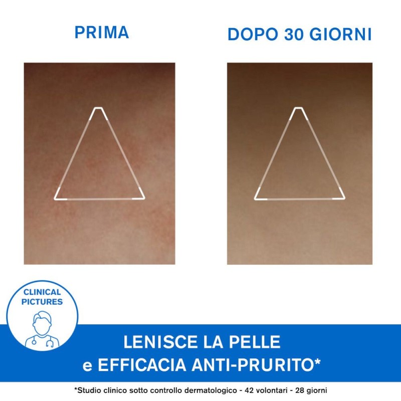 Primo piano di Uriage Xemose Cerato Antirritazione 200ml Primo piano di Uriage Xemose Cerato Antirritazione 200ml