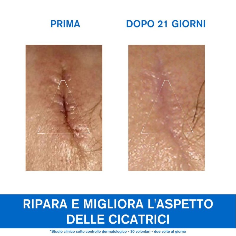 Foto ravvicinata di Bariederm Cica-Crema per Problemi Cutanei 100ml Foto ravvicinata di Bariederm Cica-Crema per Problemi Cutanei 100ml