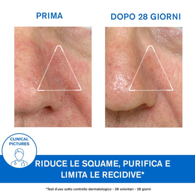 Packaging del prodotto Uriage Ds Emulsione per Irritazioni e Desquamazione 40ml Packaging del prodotto Uriage Ds Emulsione per Irritazioni e Desquamazione 40ml