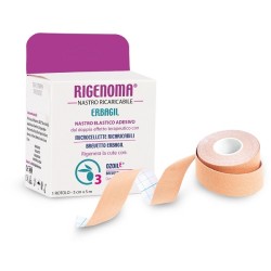 Rigenoma Nastro...