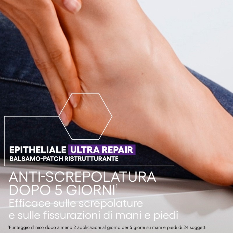A-Derma Epitheliale A.H Ultra Balsamo Ristrutturante e Lenitivo 50 g A-Derma Epitheliale A.H Ultra Balsamo Ristrutturante e Lenitivo 50 g