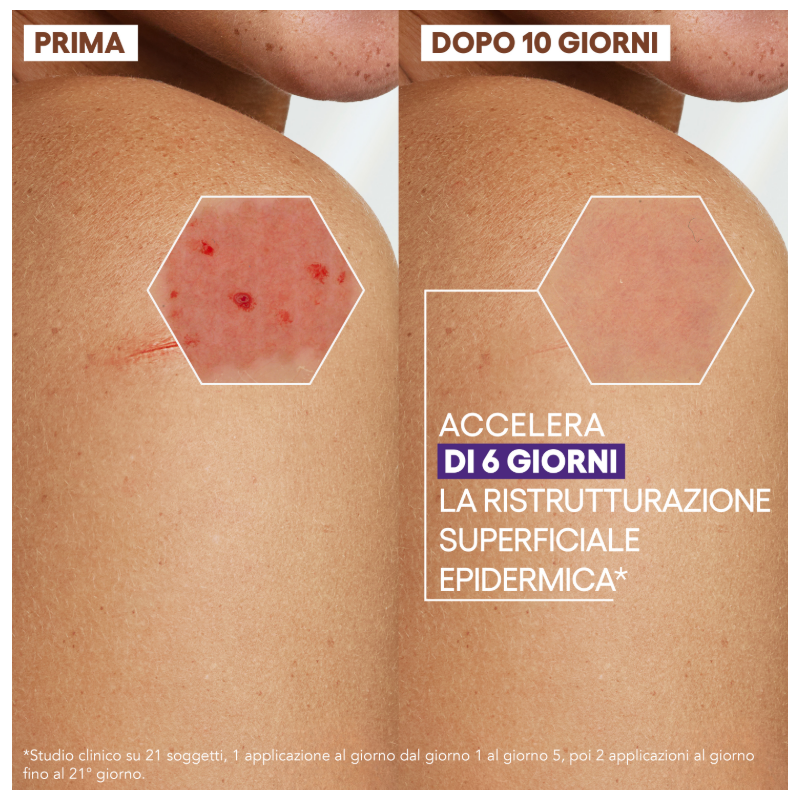 Aderma Epitheliale Ultra Ha+ Crema Riparatrice Anti Segni 100ml Aderma Epitheliale Ultra Ha+ Crema Riparatrice Anti Segni 100ml