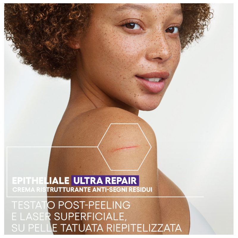 Aderma Epitheliale Ultra Ha+ Crema Riparatrice Anti Segni 100ml Aderma Epitheliale Ultra Ha+ Crema Riparatrice Anti Segni 100ml