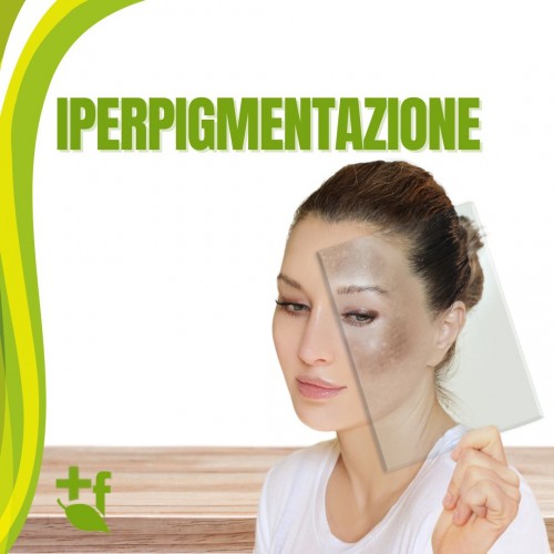 Iperpigmentazione