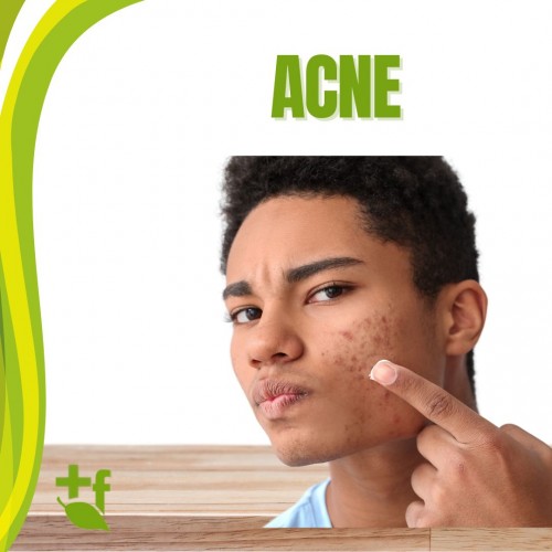 foto Acne