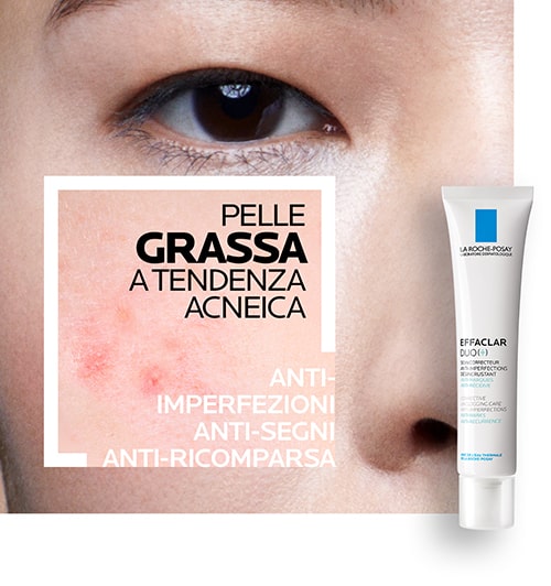 La Roche Posay pelle grassa